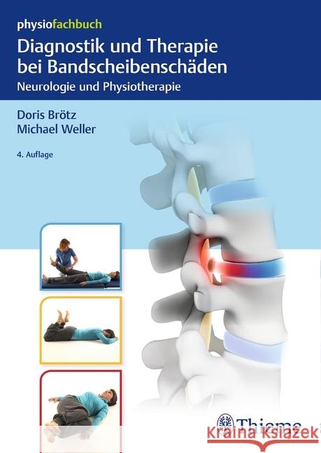 Diagnostik und Therapie bei Bandscheibenschäden : Neurologie und Physiotherapie Brötz, Doris; Weller, Michael 9783132401884 Thieme, Stuttgart - książka