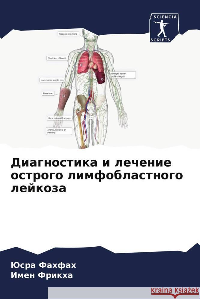 Diagnostika i lechenie ostrogo limfoblastnogo lejkoza Fahfah, Jusra, Frikha, Imen 9786208184940 Sciencia Scripts - książka