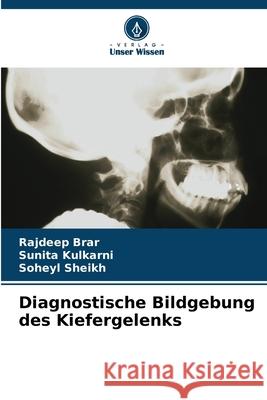Diagnostische Bildgebung des Kiefergelenks Rajdeep Brar Sunita Kulkarni Soheyl Sheikh 9786207674220 Verlag Unser Wissen - książka