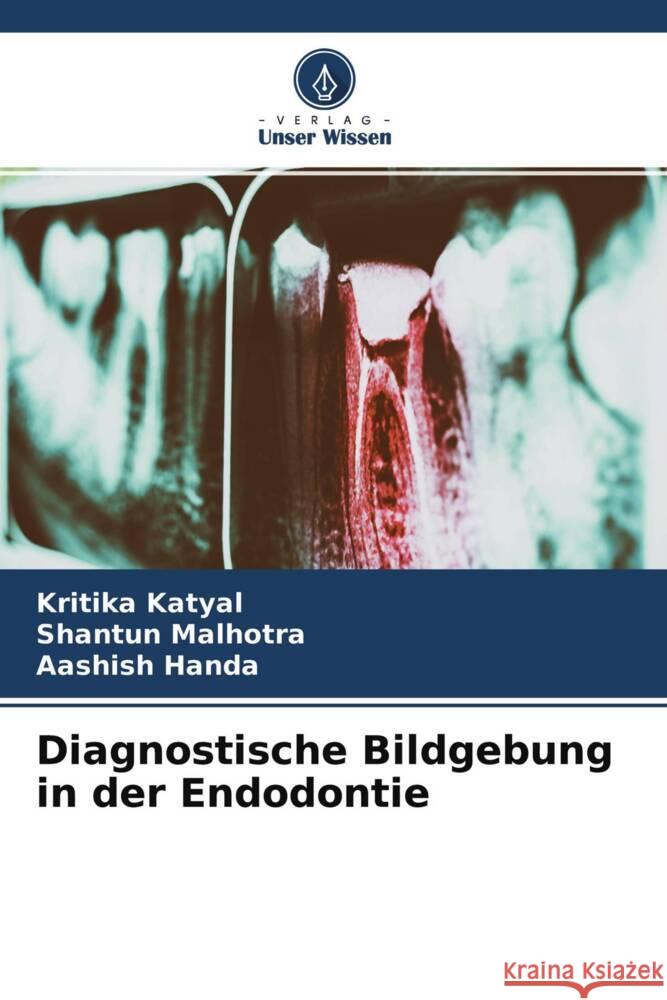 Diagnostische Bildgebung in der Endodontie Katyal, Kritika, Malhotra, Shantun, Handa, Aashish 9786204421988 Verlag Unser Wissen - książka