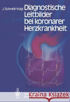 Diagnostische Leitbilder Bei Koronarer Herzkrankheit Schmidt-Voigt, J. 9783642676840 Springer - książka