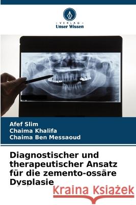 Diagnostischer und therapeutischer Ansatz für die zemento-ossäre Dysplasie Slim, Afef, Khalifa, Chaima, Ben Messaoud, Chaima 9786209019937 Verlag Unser Wissen - książka