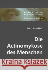 Die Actinomykose des Menschen Ponfick, Emil 9783836441254 VDM Verlag Dr. Müller - książka