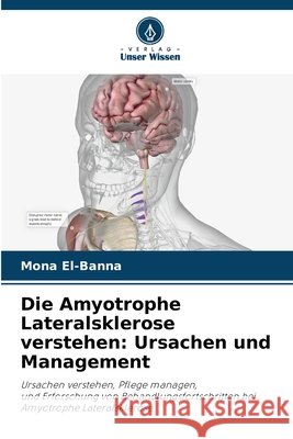 Die Amyotrophe Lateralsklerose verstehen: Ursachen und Management El-Banna, Mona 9786207839414 Verlag Unser Wissen - książka
