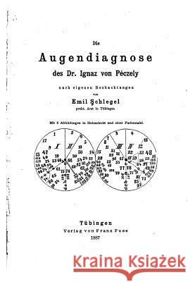 Die Augendiagnose des Dr. Ignaz von Péczely Schlegel, Emil 9781522955689 Createspace Independent Publishing Platform - książka