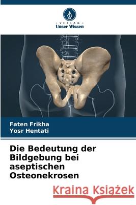 Die Bedeutung der Bildgebung bei aseptischen Osteonekrosen Frikha, Faten, Hentati, Yosr 9786202325318 Verlag Unser Wissen - książka