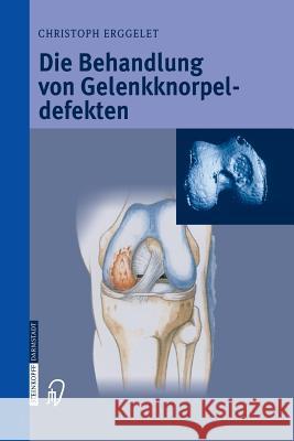 Die Behandlung Von Gelenkknorpeldefekten Erggelet, Christoph 9783642621697 Steinkopff-Verlag Darmstadt - książka