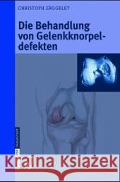 Die Behandlung Von Gelenkknorpeldefekten Christoph Erggelet 9783798514669 Steinkopff-Verlag Darmstadt - książka