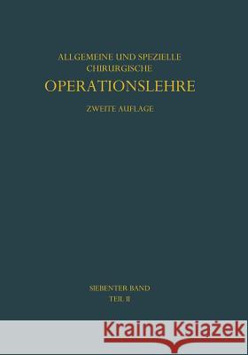 Die Eingriffe Bei Den Bauchbrüchen: Einschliesslich Der Zwerchfellbrüche Kirschner, M. 9783642946868 Springer - książka