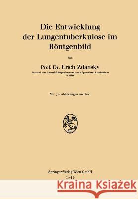 Die Entwicklung Der Lungentuberkulose Im Röntgenbild Zdansky, Erich 9783211801277 Springer - książka