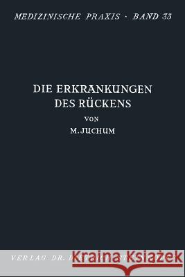 Die Erkrankungen Des Rückens: Pathologie Und Therapie Juchum, Martin 9783642862540 Steinkopff-Verlag Darmstadt - książka