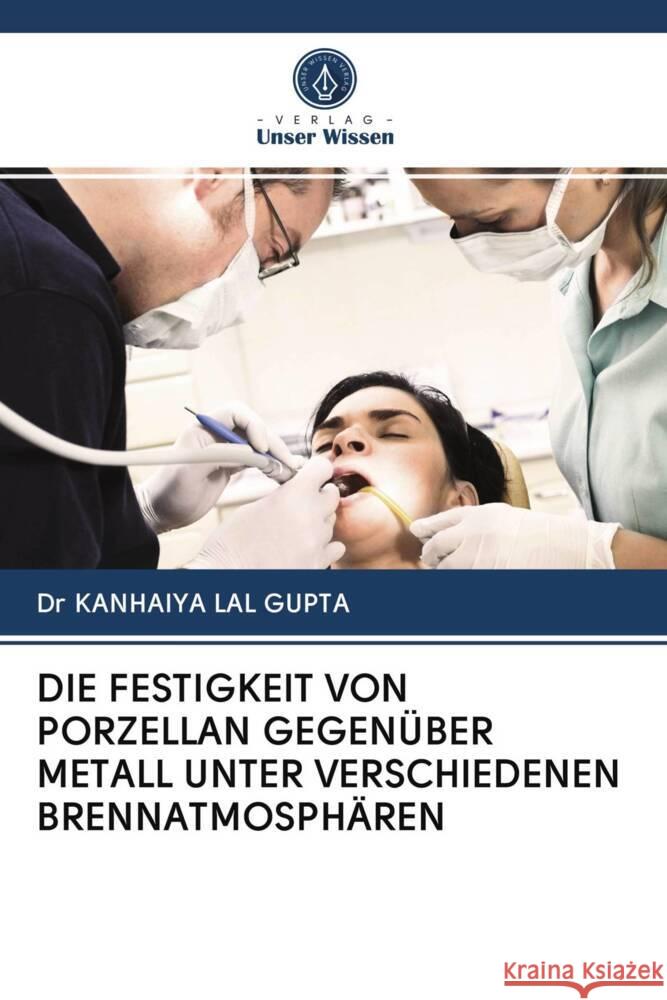 DIE FESTIGKEIT VON PORZELLAN GEGENÜBER METALL UNTER VERSCHIEDENEN BRENNATMOSPHÄREN LAL GUPTA, Dr KANHAIYA 9786202902731 Verlag Unser Wissen - książka