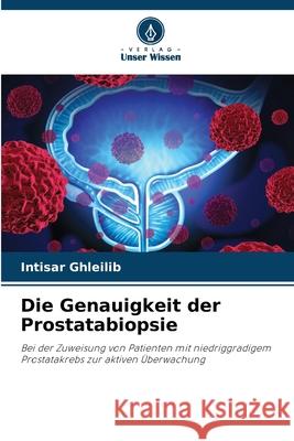 Die Genauigkeit der Prostatabiopsie Intisar Ghleilib 9786207911554 Verlag Unser Wissen - książka