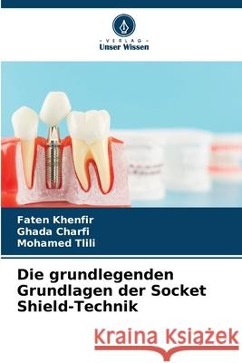 Die grundlegenden Grundlagen der Socket Shield-Technik Khenfir, Faten, Charfi, Ghada, Tlili, Mohamed 9786209282768 Verlag Unser Wissen - książka