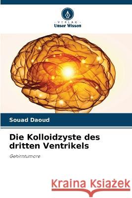 Die Kolloidzyste des dritten Ventrikels Souad Daoud 9786205389645 Verlag Unser Wissen - książka