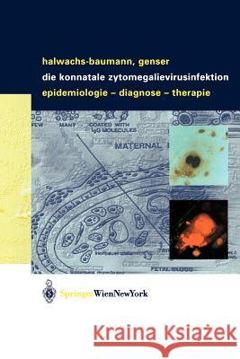 Die Konnatale Zytomegalievirusinfektion: Epidemiologie - Diagnose - Therapie Halwachs-Baumann, Gabriele 9783211008010 Springer - książka