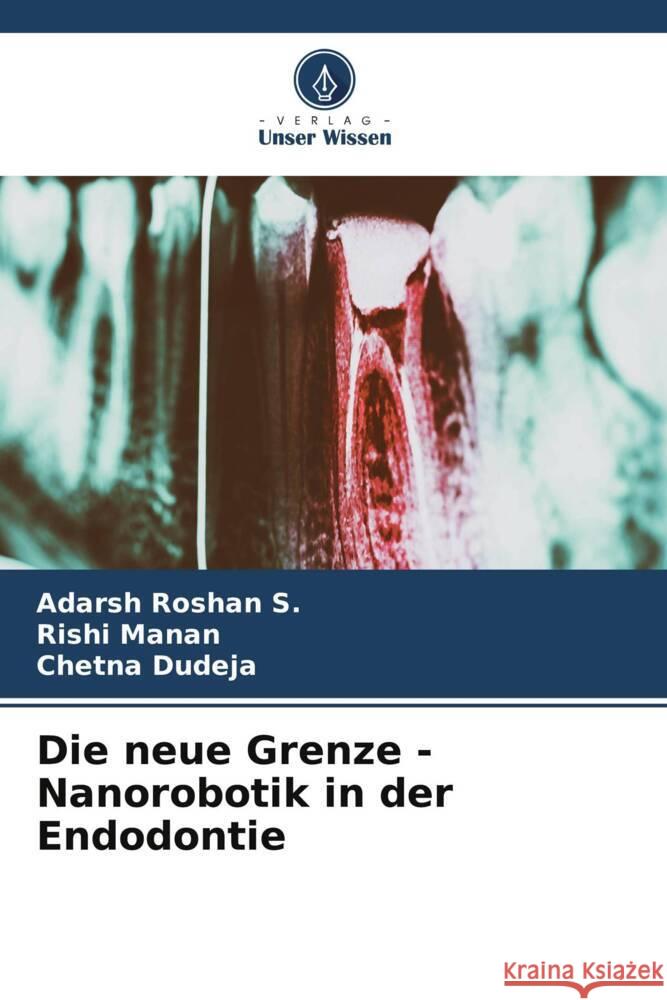 Die neue Grenze - Nanorobotik in der Endodontie Roshan S., Adarsh, Manan, Rishi, Dudeja, Chetna 9786206587408 Verlag Unser Wissen - książka