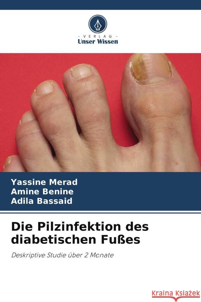 Die Pilzinfektion des diabetischen Fußes Merad, Yassine, Benine, Amine, Bassaid, Adila 9786206192053 Verlag Unser Wissen - książka