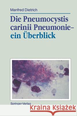 Die Pneumocystis carinii Pneumonie— ein Überblick Manfred Dietrich 9783540512332 Springer-Verlag Berlin and Heidelberg GmbH &  - książka