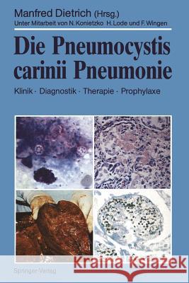Die Pneumocystis Carinii Pneumonie: Klinik - Diagnostik - Therapie - Prophylaxe Dietrich, Manfred 9783540511779 Not Avail - książka