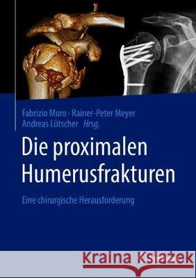 Die Proximalen Humerusfrakturen: Eine Chirurgische Herausforderung Moro, Fabrizio 9783662608524 Springer - książka