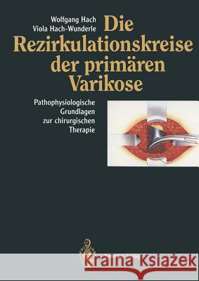 Die Rezirkulationskreise Der Primären Varikose: Pathophysiologische Grundlagen Zur Chirurgischen Therapie Hach, Wolfgang 9783662008782 Springer - książka