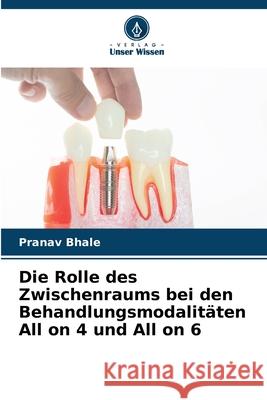 Die Rolle des Zwischenraums bei den Behandlungsmodalit?ten All on 4 und All on 6 Pranav Bhale 9786207629138 Verlag Unser Wissen - książka