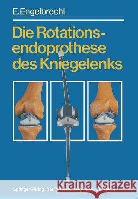 Die Rotationsendoprothese Des Kniegelenks Buchholz, H. W. 9783642698194 Springer - książka