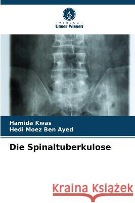 Die Spinaltuberkulose Hamida Kwas Hedi Moez Ben Ayed  9786205978979 Verlag Unser Wissen - książka