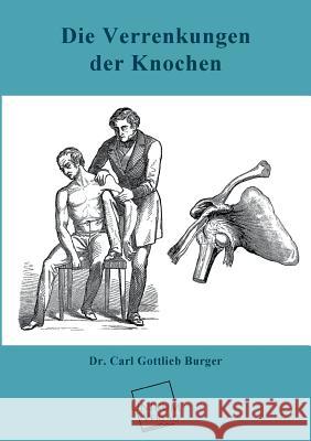 Die Verrenkungen Der Knochen Burger, Carl Gottlieb 9783845740331 Unikum - książka