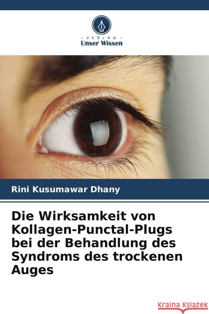 Die Wirksamkeit von Kollagen-Punctal-Plugs bei der Behandlung des Syndroms des trockenen Auges Rini Kusumawa 9786208108816 Verlag Unser Wissen - książka