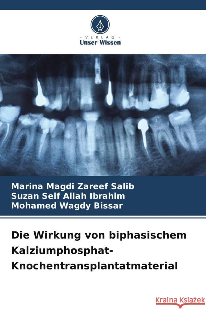 Die Wirkung von biphasischem Kalziumphosphat-Knochentransplantatmaterial Magdi Zareef Salib, Marina, Seif Allah Ibrahim, Suzan, Wagdy Bissar, Mohamed 9786205440490 Verlag Unser Wissen - książka