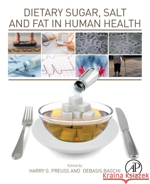 Dietary Sugar, Salt and Fat in Human Health Harry G. Preuss Debasis Bagchi 9780128169186 Academic Press - książka