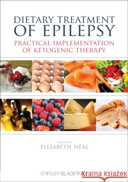 Dietary Treatment of Epilepsy: Practical Implementation of Ketogenic Therapy Neal, Elizabeth 9780470670415  - książka