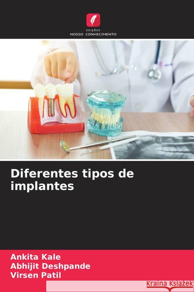 Diferentes tipos de implantes Kale, Ankita, Deshpande, Abhijit, Patil, Virsen 9786208212056 Edições Nosso Conhecimento - książka