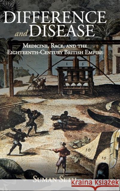 Difference and Disease: Medicine, Race, and the Eighteenth-Century British Empire Suman Seth 9781108418300 Cambridge University Press - książka