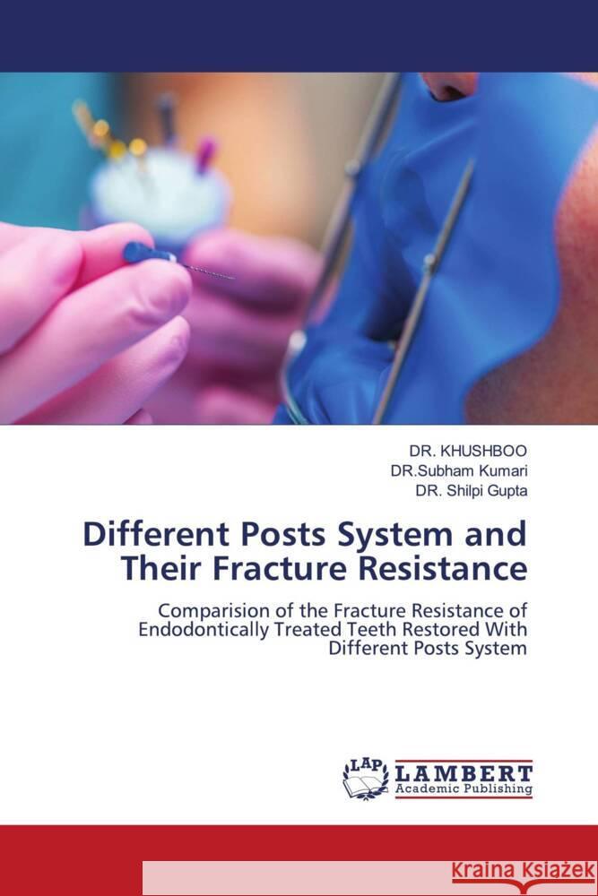 Different Posts System and Their Fracture Resistance KHUSHBOO, DR., Kumari, DR.Subham, Gupta, Dr. Shilpi 9786204208930 LAP Lambert Academic Publishing - książka