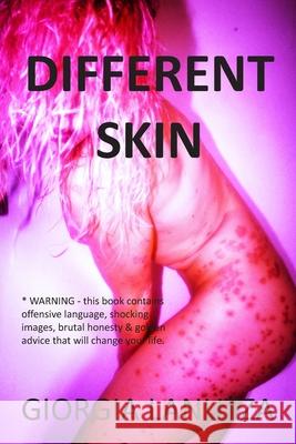 Different Skin Giorgia Lanuzza 9781915229748 Clink Street Publishing - książka
