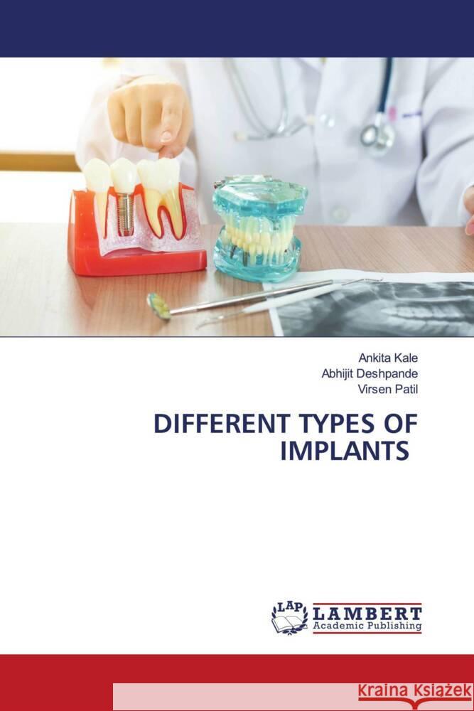 DIFFERENT TYPES OF IMPLANTS Kale, Ankita, Deshpande, Abhijit, Patil, Virsen 9786208116491 LAP Lambert Academic Publishing - książka