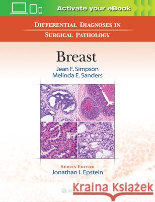 Differential Diagnoses in Surgical Pathology: Breast Simpson, Jean F. 9781496300652 LWW - książka
