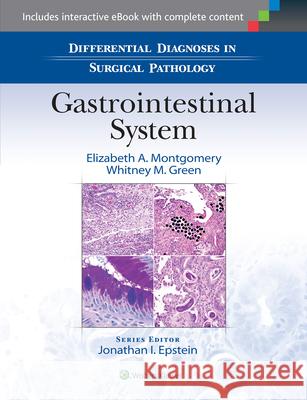 Differential Diagnoses in Surgical Pathology: Gastrointestinal System Elizabeth A. Montgomery 9781451191899 Lippincott Williams & Wilkins - książka