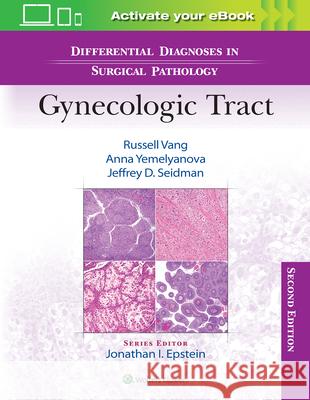 Differential Diagnoses in Surgical Pathology: Gynecologic Tract Jeffrey D., MD Seidman 9781975199012 Wolters Kluwer Health - książka