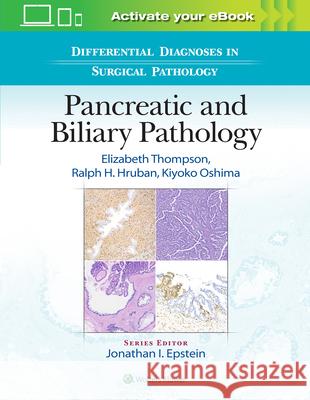 Differential Diagnoses in Surgical Pathology: Pancreatic and Biliary Pathology Elizabeth Thompson Ralph H. Hruban Kiyoko Oshima 9781975144739 LWW - książka