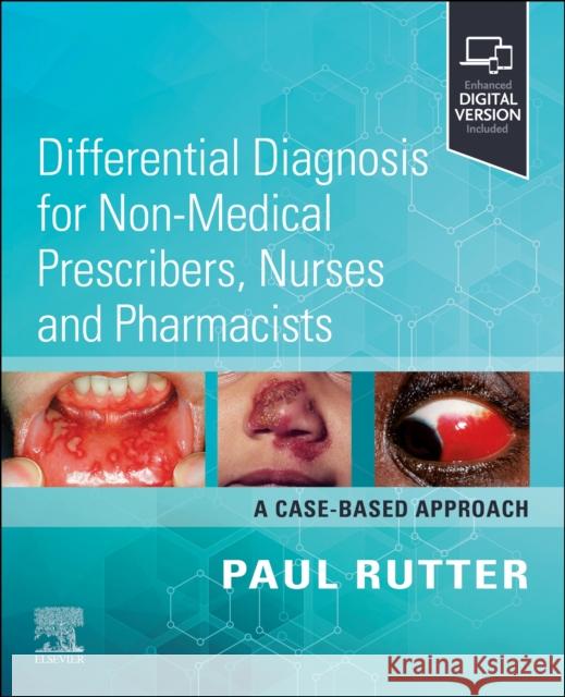 Differential Diagnosis for Non-medical Prescribers, Nurses and Pharmacists: A Case-Based Approach Paul, PhD (Professor of Pharmacy Practice, School of Pharmacy and Biomedical Sciences, University of Portsmouth, UK) Rut 9780443116049 Elsevier - książka