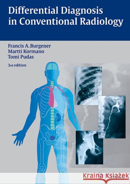 Differential Diagnosis in Conventional Radiology Francis A. Burgener Tomi Pudas Martti Kormano 9783136561034 Thieme Publishing Group - książka