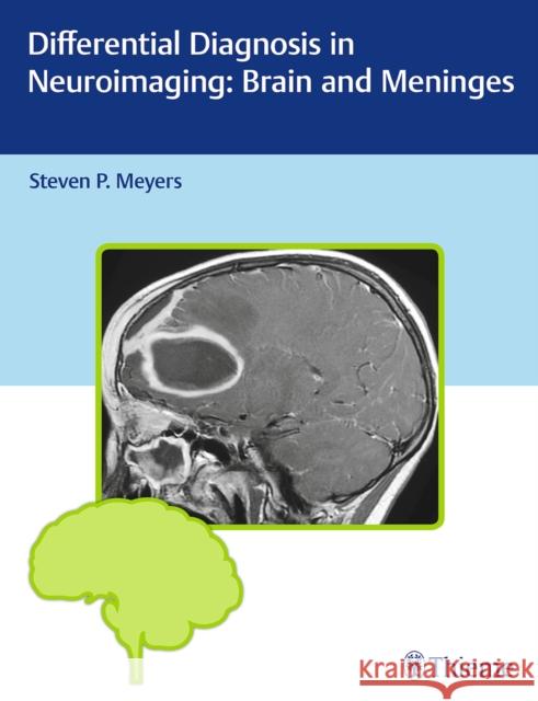 Differential Diagnosis in Neuroimaging: Brain and Meninges Steven P. Meyers 9781604067002 Thieme Medical Publishers - książka