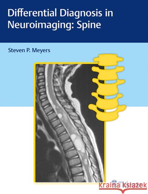 Differential Diagnosis in Neuroimaging: Spine Meyers, Steven 9781626234772 Thieme Medical Publishers - książka