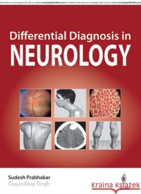 Differential Diagnosis in Neurology  Singh, Gagandeep 9789351529026  - książka