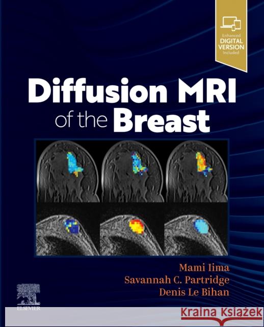 Diffusion MRI of the Breast Mami Iima Savannah Partridge Denis L 9780323797023 Elsevier - książka