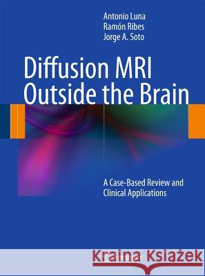 Diffusion MRI Outside the Brain: A Case-Based Review and Clinical Applications Antonio Luna, Ramón Ribes, Jorge A. Soto 9783642210518 Springer-Verlag Berlin and Heidelberg GmbH &  - książka